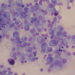 Multiple myeloma cells