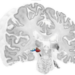 Metathalamus