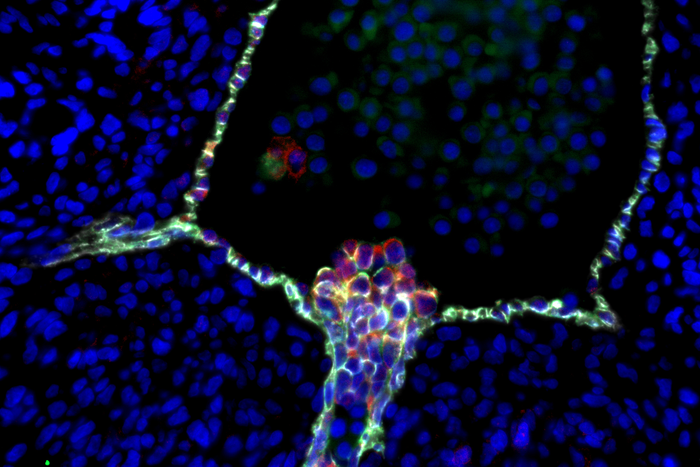 Emerging human blood stem cells in embryonic aorta