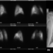 76-Year-Old, Positive for COVID-19