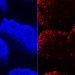 Intestinal Villi