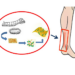 Repairing Tendons with Silk Proteins