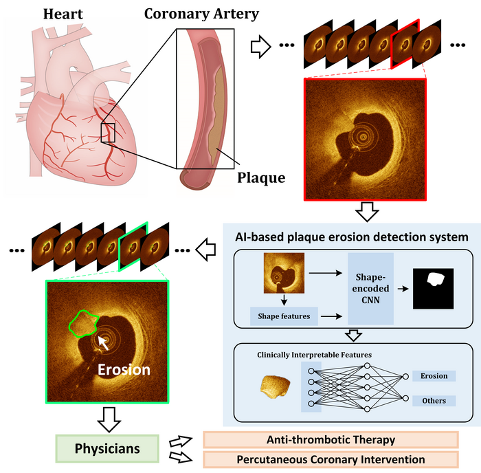 AI-based plaque detection