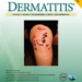 Dermatitis®