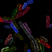 Clusters of the essential protein BamA in the outer membrane of the bacterium Escherichia coli.