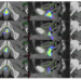 Heat maps of PSMA PET prostatic fossa recurrence in patients