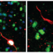 Newborn immature dentate granule neurons