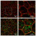 Retinal pigment epithelium in wild-type and Serpin1-null mice