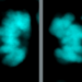 Fewer chromosome segregation errors in modern human than Neanderthal neural stem cells.