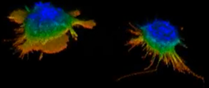 HEK 293 cells spreading