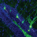 Memory-storing neurons in the hippocampus of mice with AD.