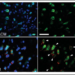 Brain Support Cells Transfer Their Mitochondria to Fight Free Radicals