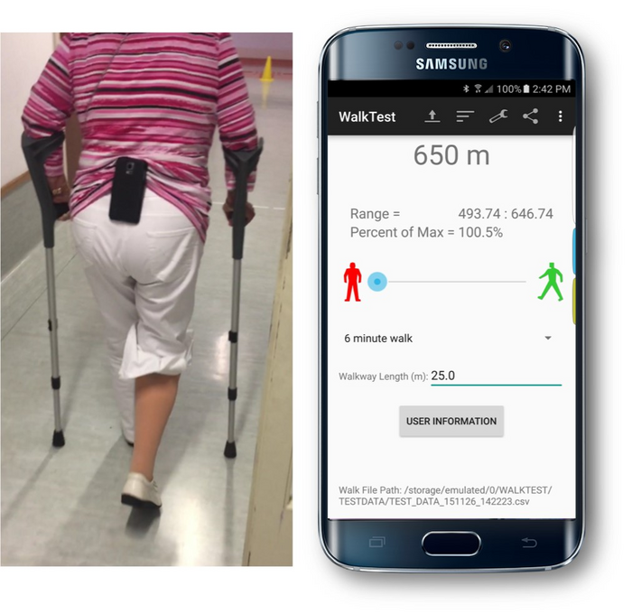 Machine learning model predicts fall risk for lower limb amputees with up to 80% accuracy, with implications for future smartphone apps