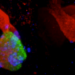 Pancreatic development in wild type mice vs. mice without PTF1A