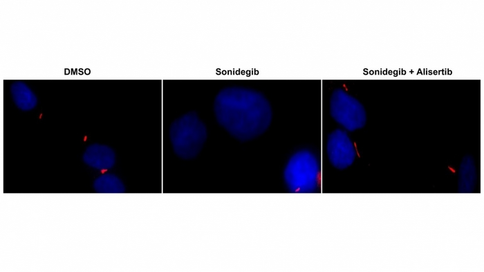 Mechanism involved in rare pediatric brain