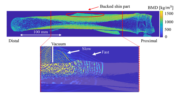 Cross-sectional view of the bone mineral density distribution