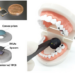 A fully packaged ultrathin dental camera and multifunctional dental images.