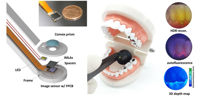 A fully packaged ultrathin dental camera and multifunctional dental images.