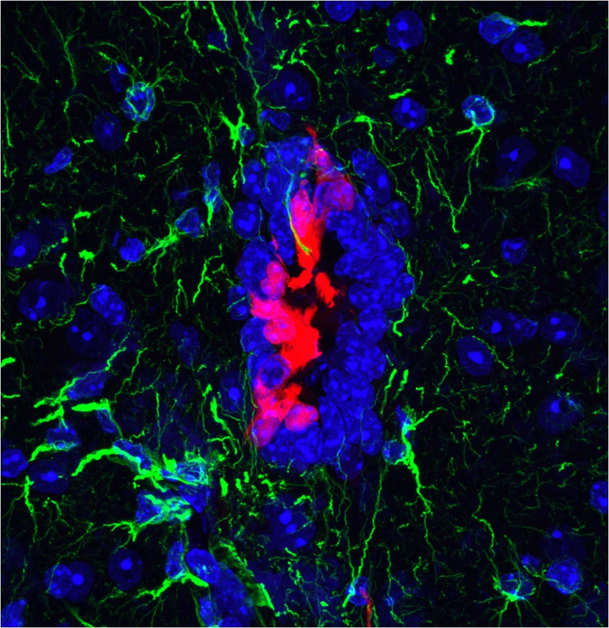 Image of uninjured mice spinal cord, with ependymal cells shown in red.