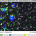 TSPO within Microglia Surrounding Beta-Amyloid Plaques in an Alzheimer's Disease Brain