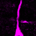 Dividing basal radial glial cell