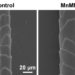 AI helps researchers design microneedle patches that restore hair in balding mice