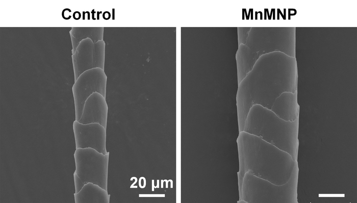 AI helps researchers design microneedle patches that restore hair in balding mice