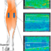 Schematic of ultrasound probe locations and ultrasound shear wave elastography images.