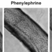 Bioengineered blood vessel