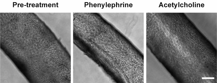 Bioengineered blood vessel