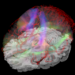 Diffusion tensor imaging (DTI)