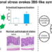 Tokyo University of Science researchers probe the link between psychological stress and irritable bowel syndrome (IBS)