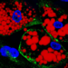 Visceral fat and COVID-19