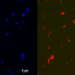 Fluorescent microscopy image of a bacterium forming membrane-spanning lipids