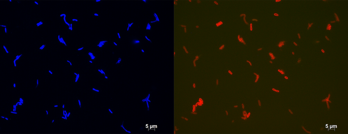 Fluorescent microscopy image of a bacterium forming membrane-spanning lipids