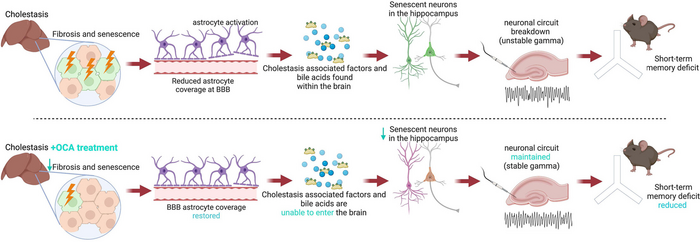 New study finds promising treatment for cognitive deficits associated with cholestatic liver disease