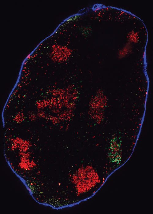 Germinal centers