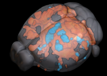 Mouse brain as seen by fMRI