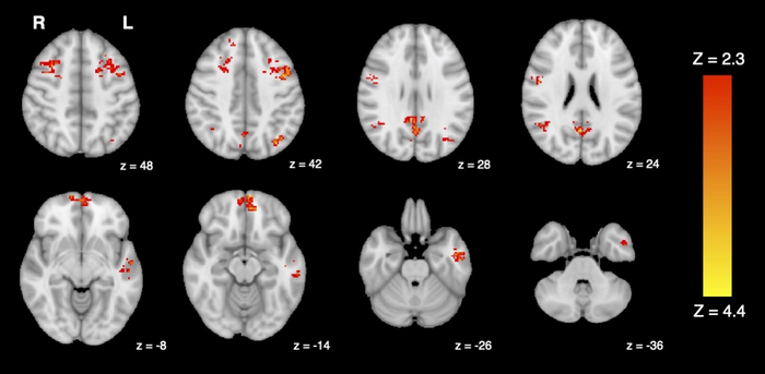 fMRI shows decreased functional connectivity in the brain following exposure to traffic pollution