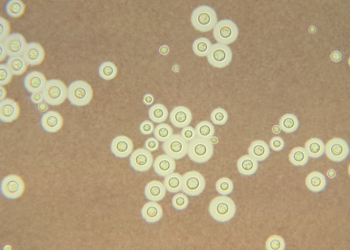 Photomicrograph of Cryptococcus deneoformans