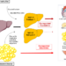 NAFLD - Hepatokines Mediate its Impact on Metabolic Diseases