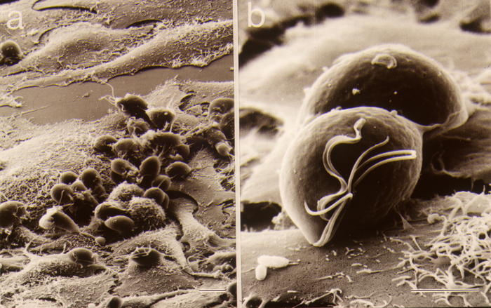 1 Ellipsoid Tvag on HeLa Cells