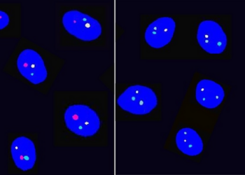 A non-randomized clinical trial to determine the safety and efficacy of a novel sperm sex selection technique