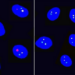 A non-randomized clinical trial to determine the safety and efficacy of a novel sperm sex selection technique