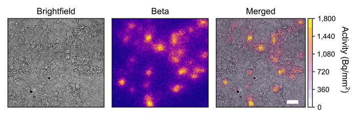 High-resolution beta imaging of 18F-FDG in breast cancer cells.