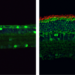 Gene editing prevents photoreceptor degeneration in mice