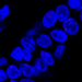 Damage to the DNA (red) in the nuclei (blue) of normal cells in the milk ducts of a BRCA mutation carrier was identified using immunofluorescence.