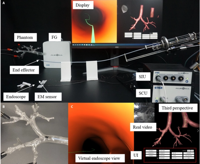 The proposed robotic bronchoscope system for navigation-assisted intervention