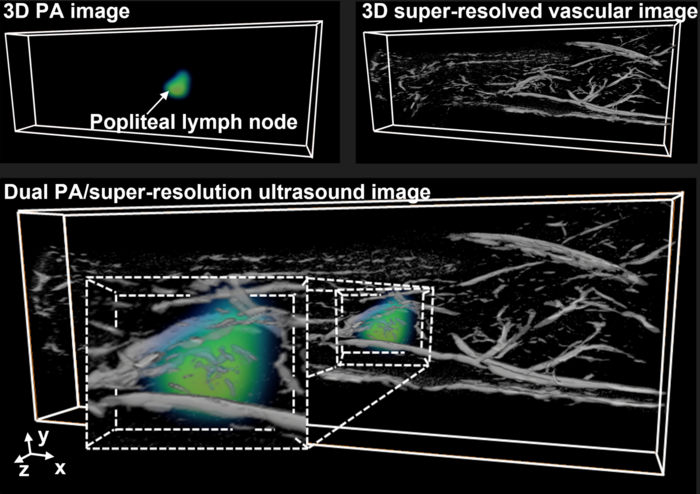 Researchers develop new lower cost, dual-modality imaging technique to facilitate earlier disease detection