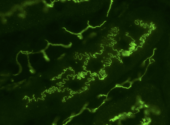 Cell interdigitation